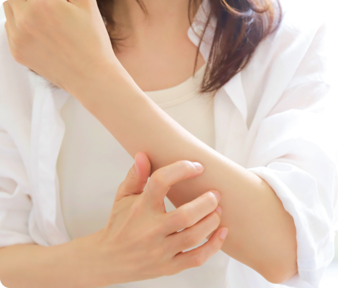 腕の皮膚にかゆみを感じる女性